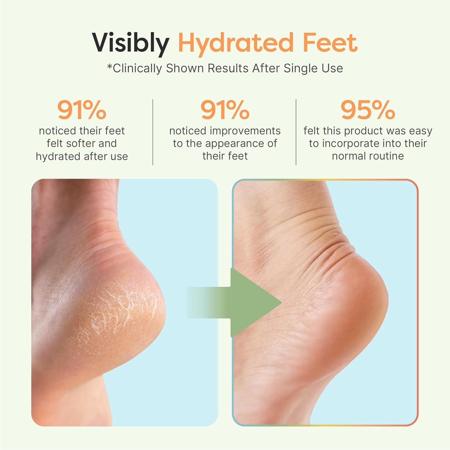 ZenToes Moisturizing Socks for Cracked Heel Treatment, Vitamin E, Olive Oil and Jojoba Oil Infused Heel Socks, Spa Gifts for Women, Relaxation Gifts for Women (Fuzzy Lilac Purple, Regular)