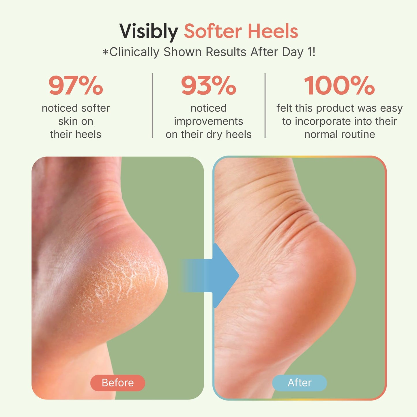 ZenToes Moisturizing Socks for Cracked Heel Treatment, Vitamin E, Olive Oil and Jojoba Oil Infused Heel Socks, Spa Gifts for Women, Relaxation Gifts for Women (Fuzzy Lilac Purple, Regular)