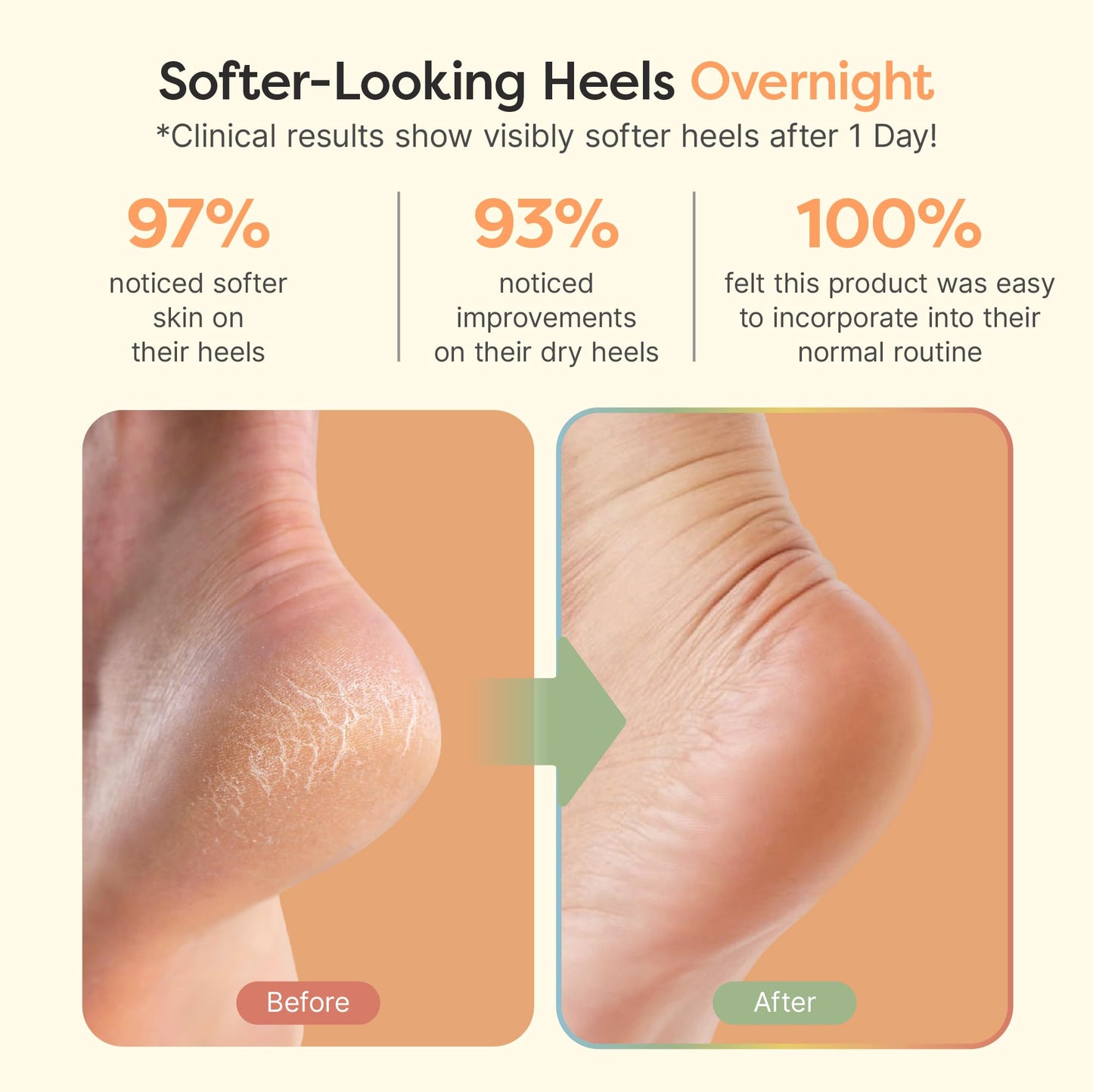 ZenToes Moisturizing Socks for Cracked Heel Treatment, Vitamin E, Olive Oil and Jojoba Oil Infused Heel Socks, Spa Gifts for Women, Relaxation Gifts for Women (Fuzzy Lilac Purple, Regular)