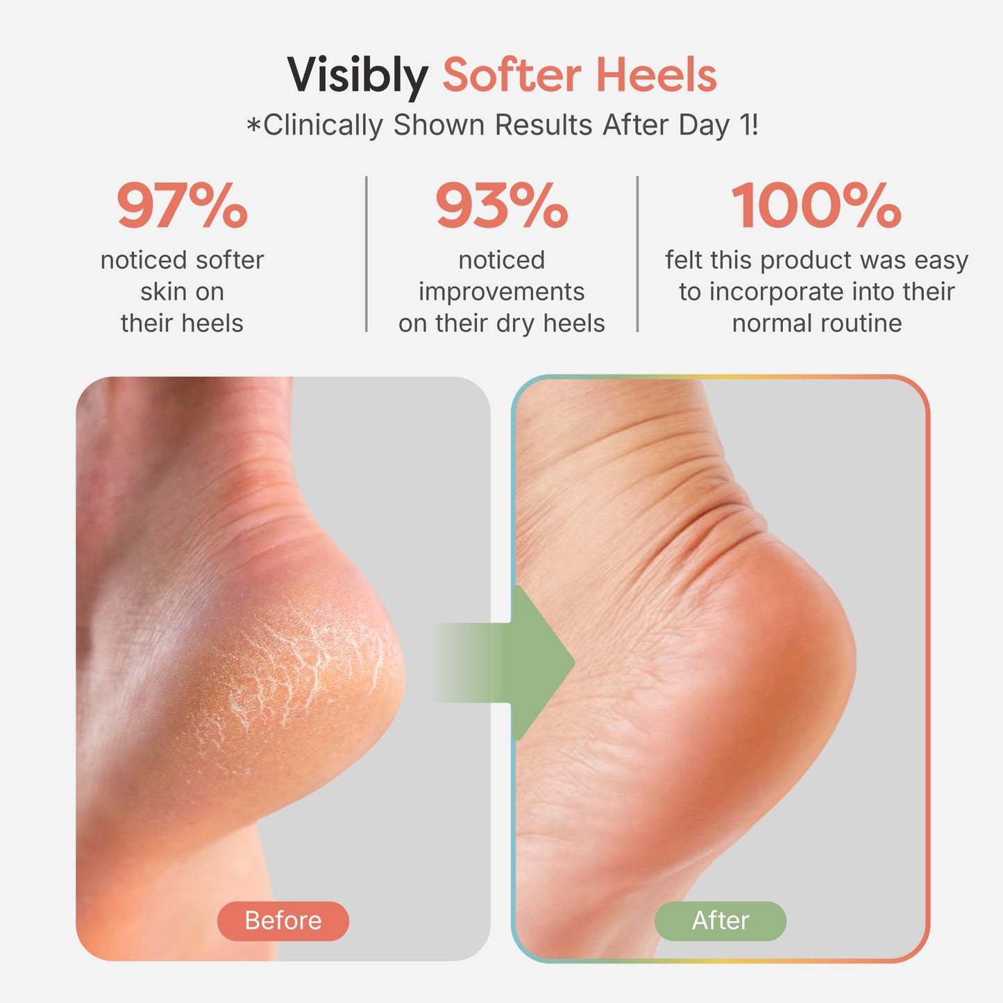 ZenToes Moisturizing Socks for Cracked Heel Treatment, Vitamin E, Olive Oil and Jojoba Oil Infused Heel Socks, Spa Gifts for Women, Relaxation Gifts for Women (Fuzzy Lilac Purple, Regular)