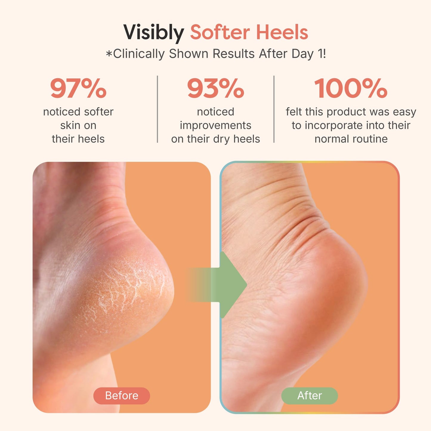 ZenToes Moisturizing Socks for Cracked Heel Treatment, Vitamin E, Olive Oil and Jojoba Oil Infused Heel Socks, Spa Gifts for Women, Relaxation Gifts for Women (Fuzzy Lilac Purple, Regular)