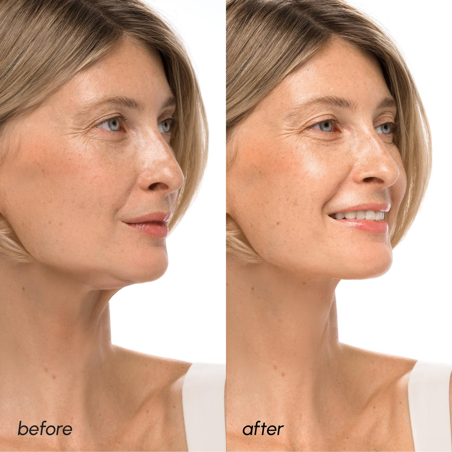 MAREE V Line Lifting Mask with 24K Gold – Deep Collagen Face Mask for Women – Jawline Shaper Mask with Retinol & Hyaluronic Acid – Neck Tightening & Firming - Double Chin Strap for Face Lift