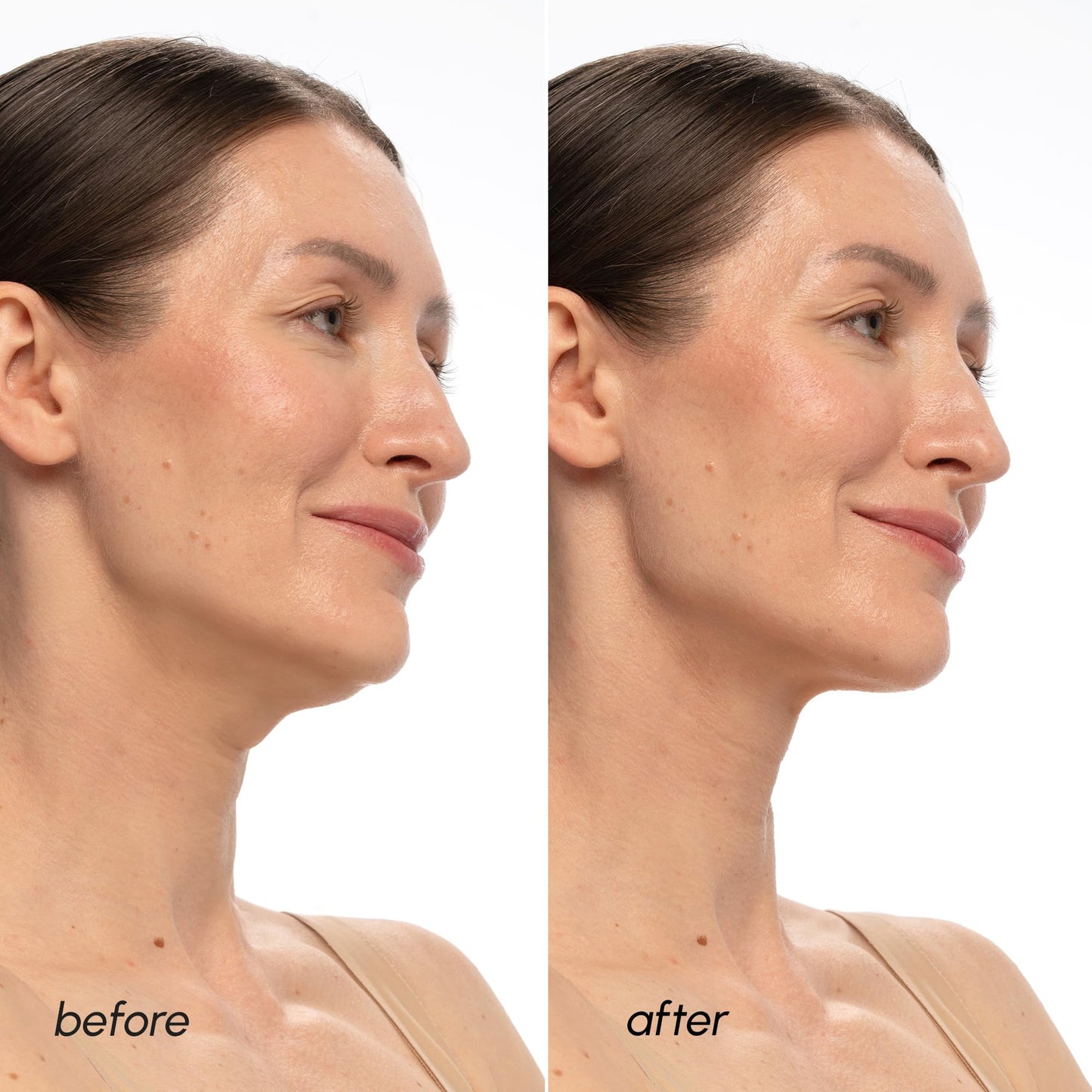 MAREE V Line Lifting Mask with 24K Gold – Deep Collagen Face Mask for Women – Jawline Shaper Mask with Retinol & Hyaluronic Acid – Neck Tightening & Firming - Double Chin Strap for Face Lift