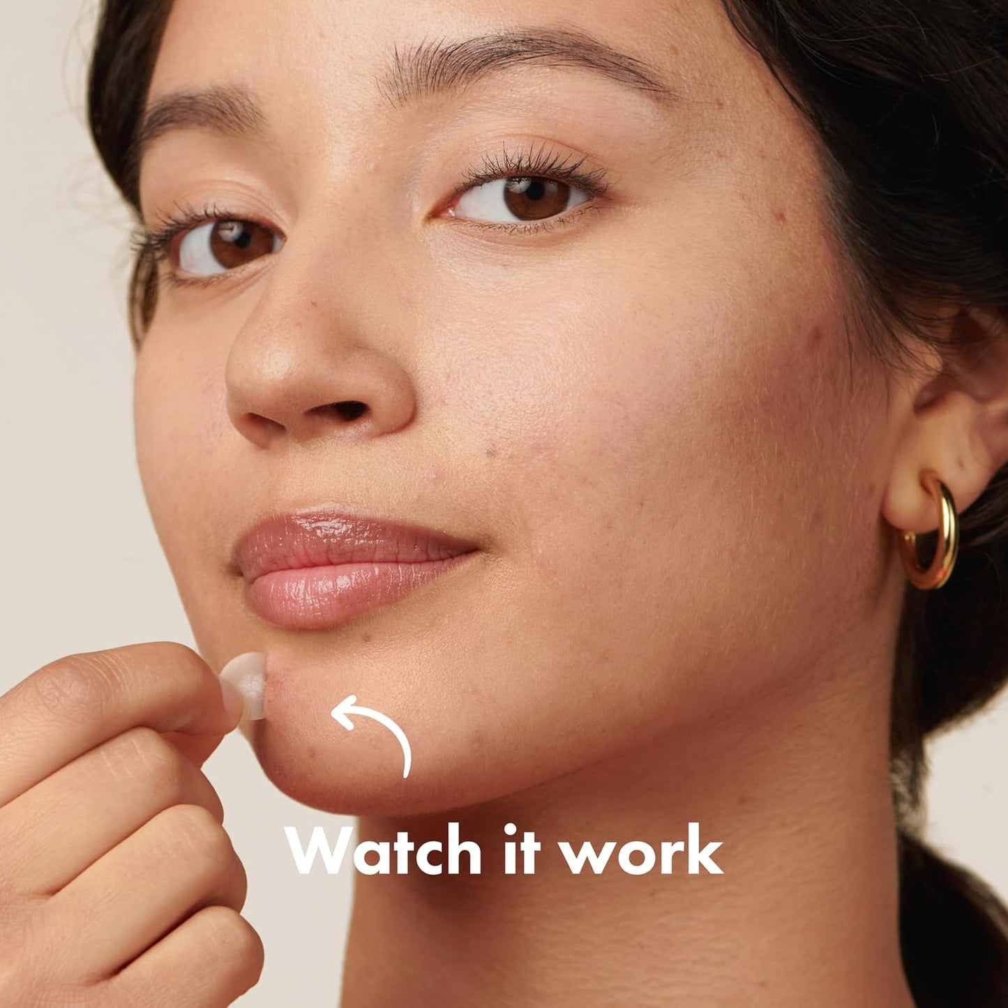 Mighty Patch Original from Hero Cosmetics - Hydrocolloid Acne Pimple Patch for Zits and Blemishes, Spot Treatment Stickers for Face and Skin, Vegan and Cruelty Free (36 Count)